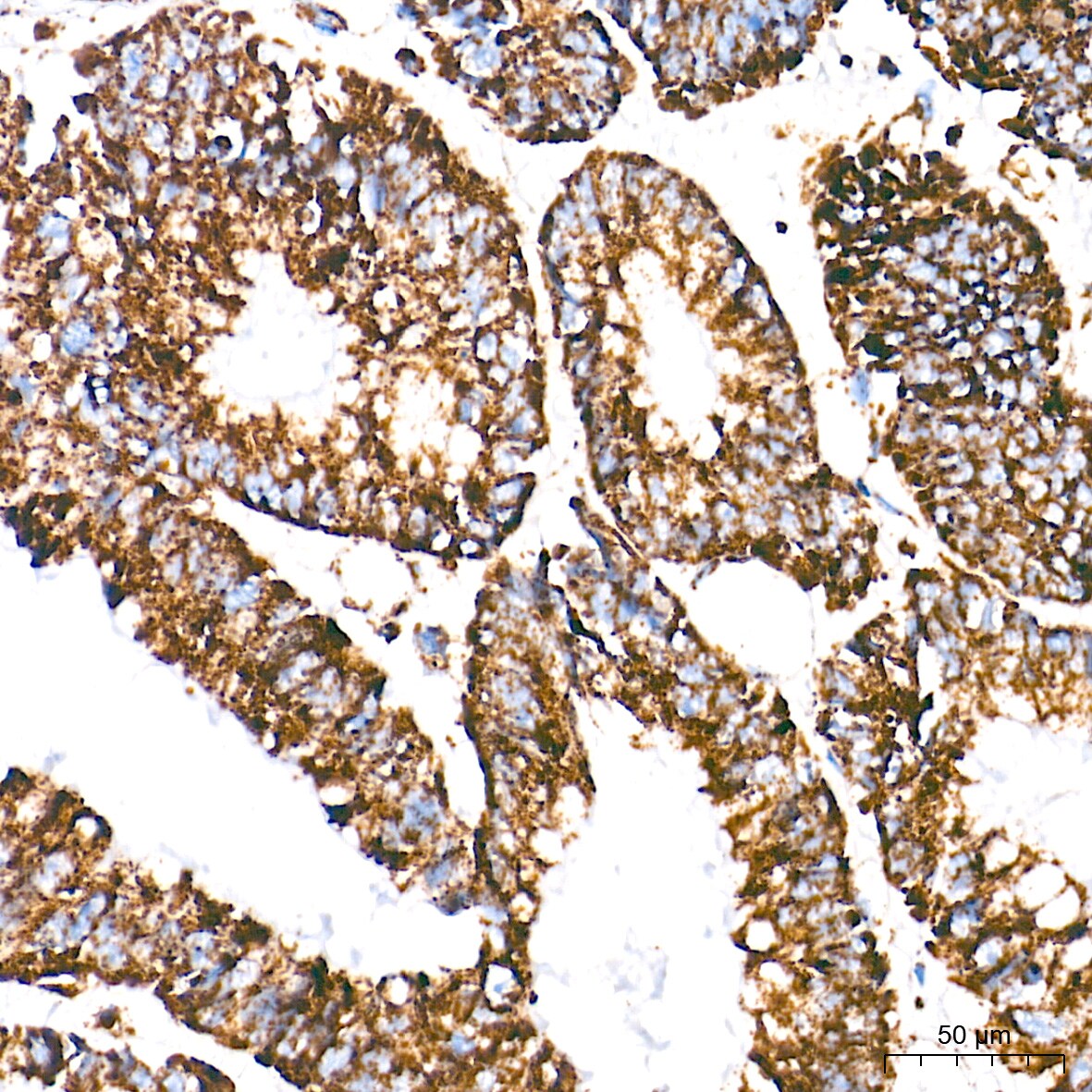 UQCRC2 Antibody (3E3O8)