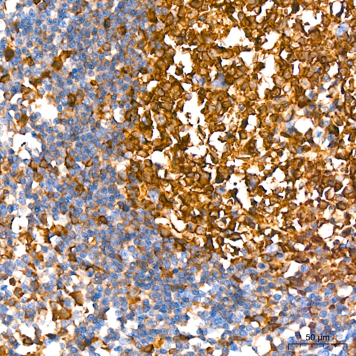 Stathmin 1 Antibody (7Y7H4)
