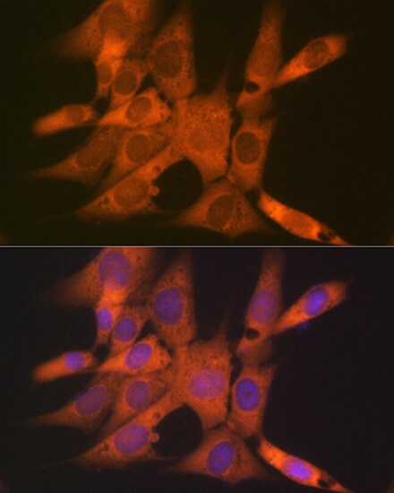 CLEC3B/Tetranectin Antibody (3E5Y7)