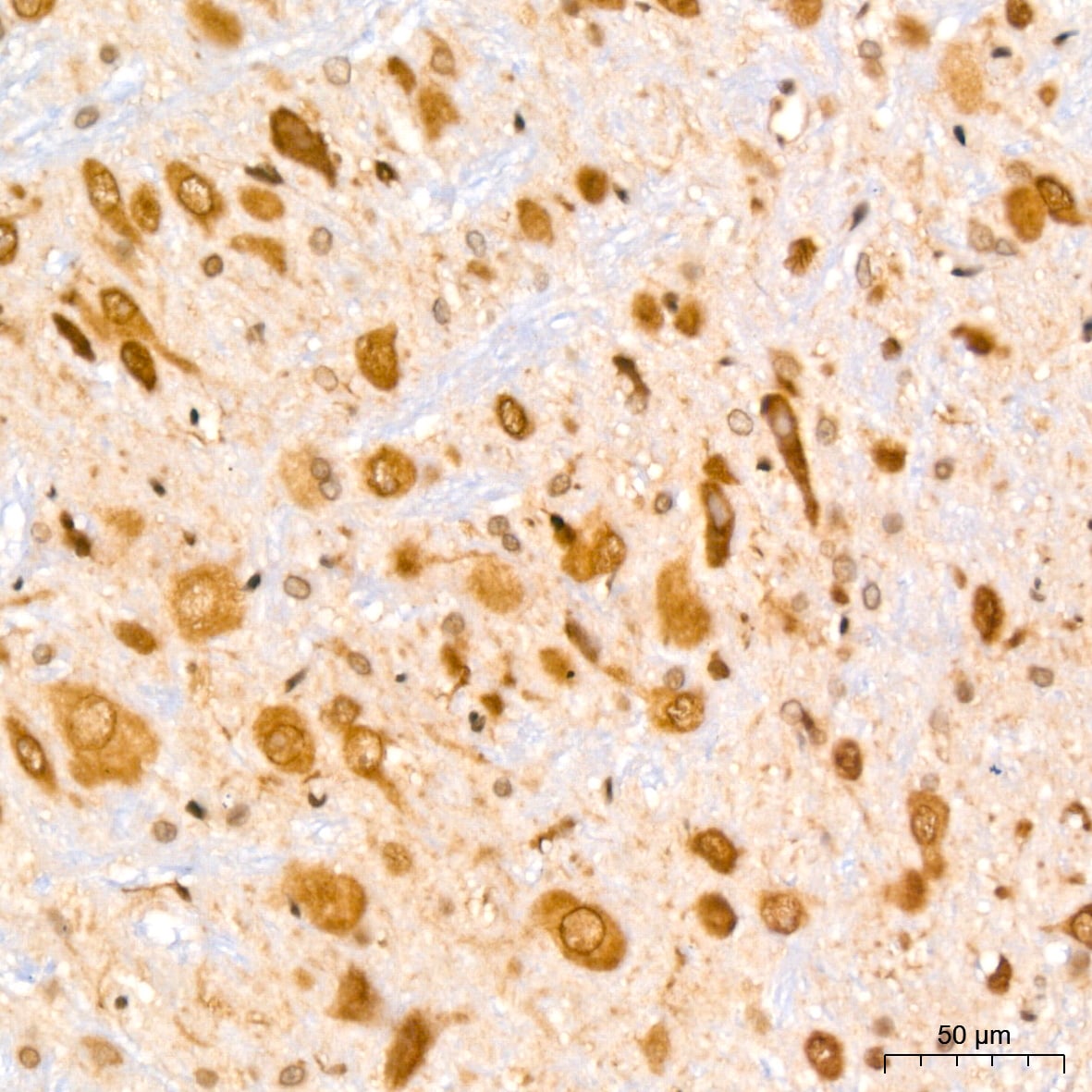 UBE2I/Ubc9 Antibody (6Z9V6)