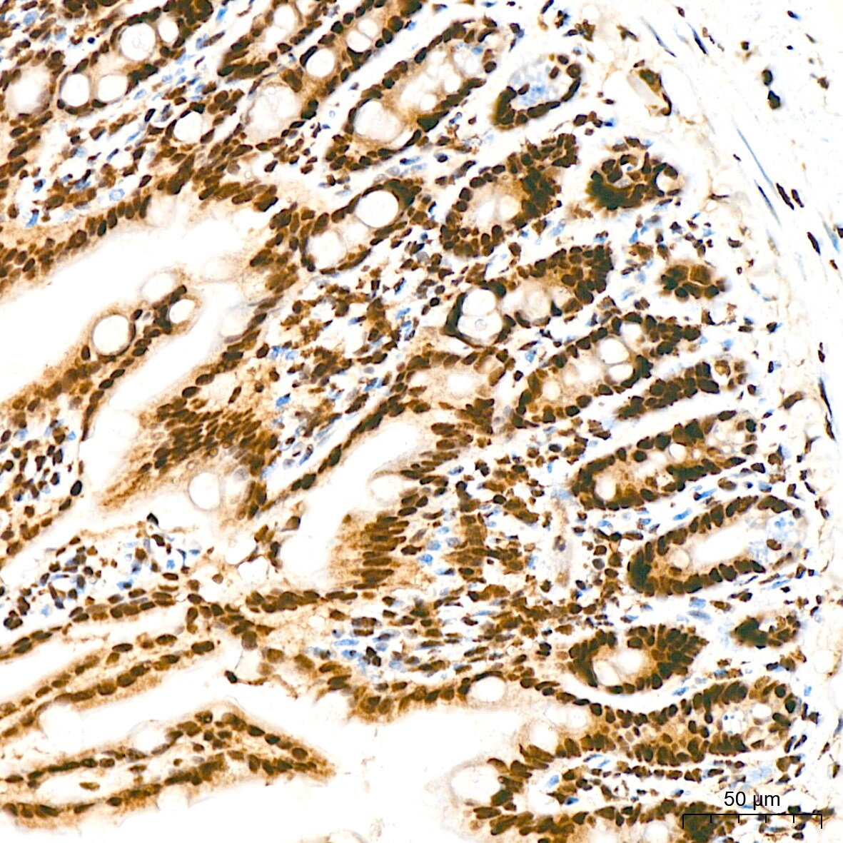 DKC1 Antibody (2W2V6)