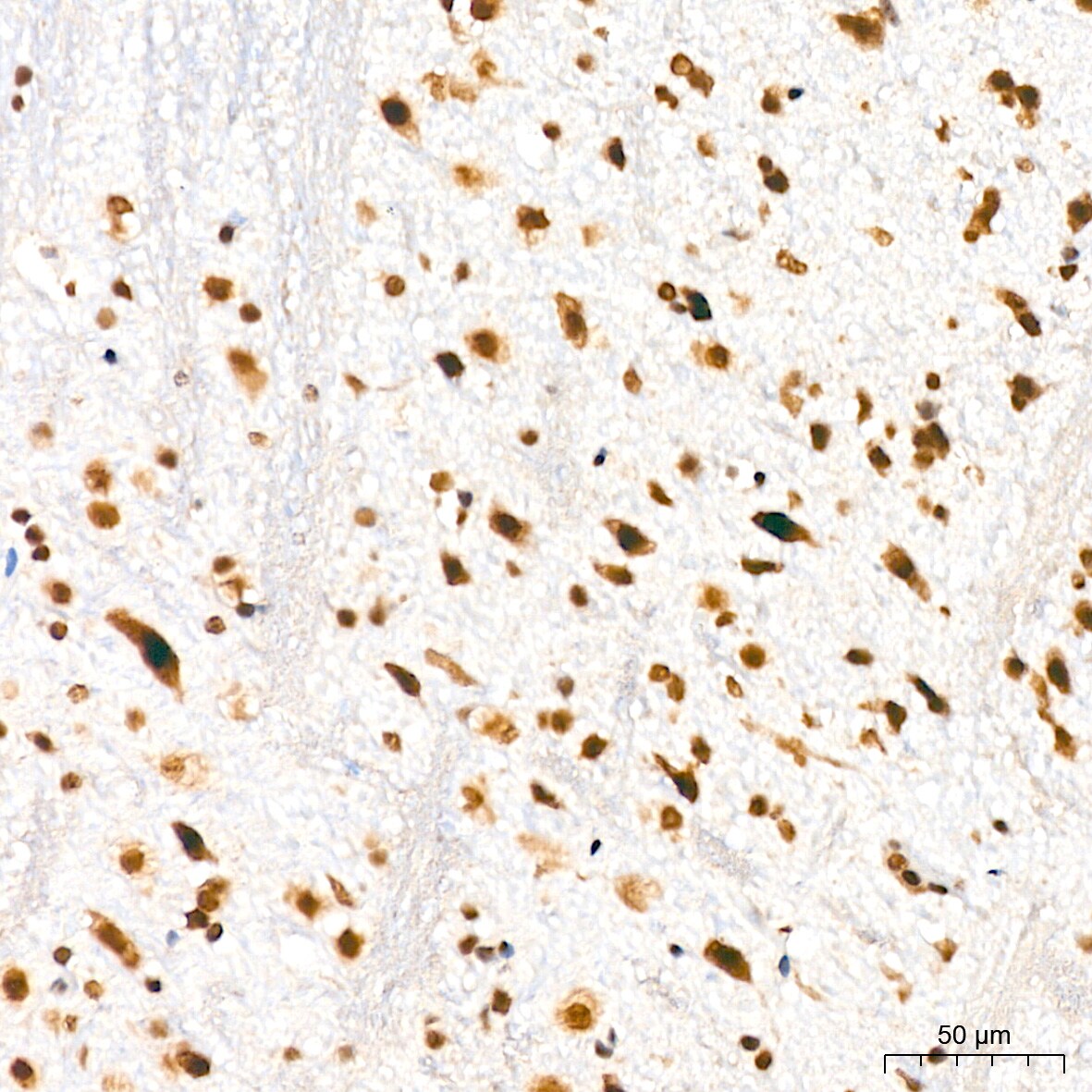 DKC1 Antibody (2W2V6)