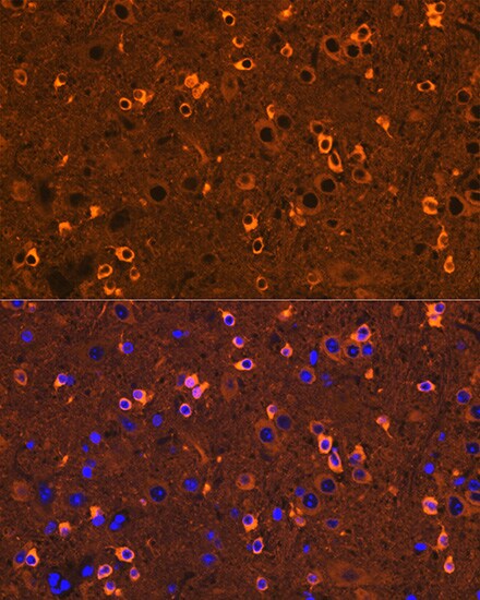 CRMP2 Antibody (0A1T1)