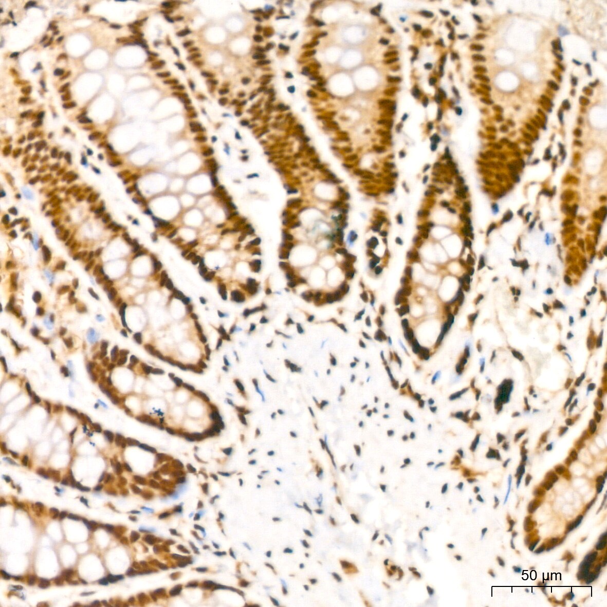 NuMA Antibody (6D4I4)