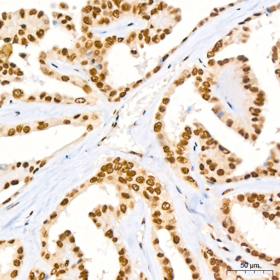 NuMA Antibody (6D4I4)