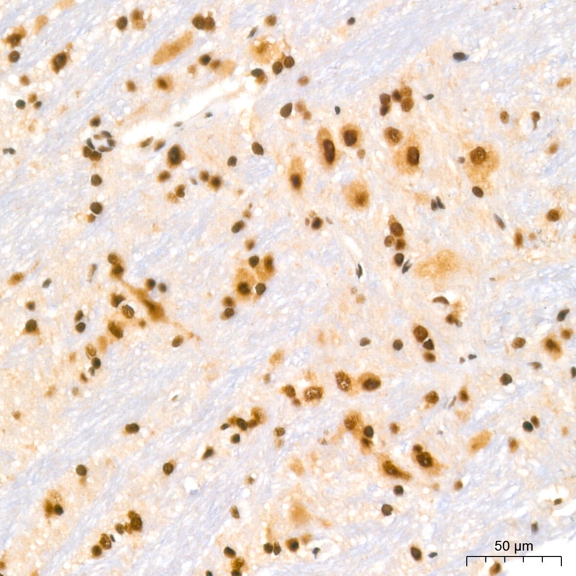 NuMA Antibody (6D4I4)