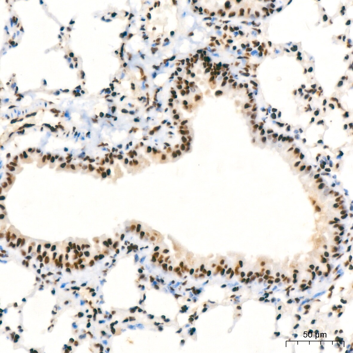 NuMA Antibody (6D4I4)
