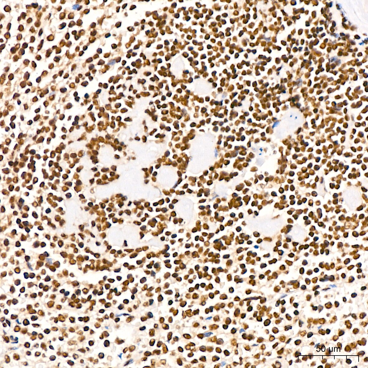 NuMA Antibody (6D4I4)
