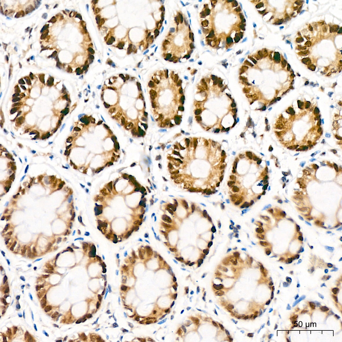KAT1 Antibody (7U2O3)