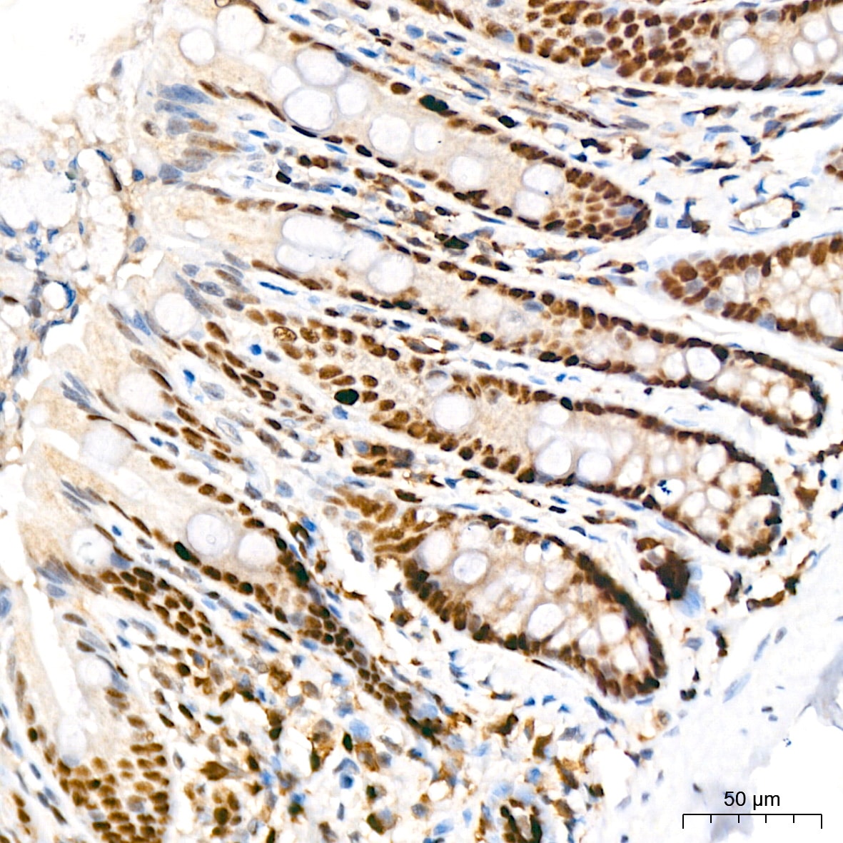 KAT1 Antibody (7U2O3)