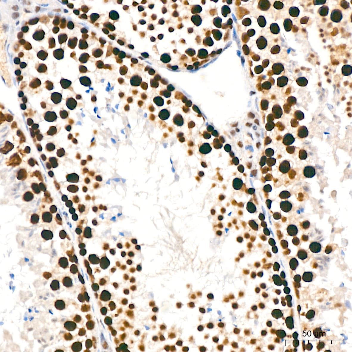 KAT1 Antibody (7U2O3)