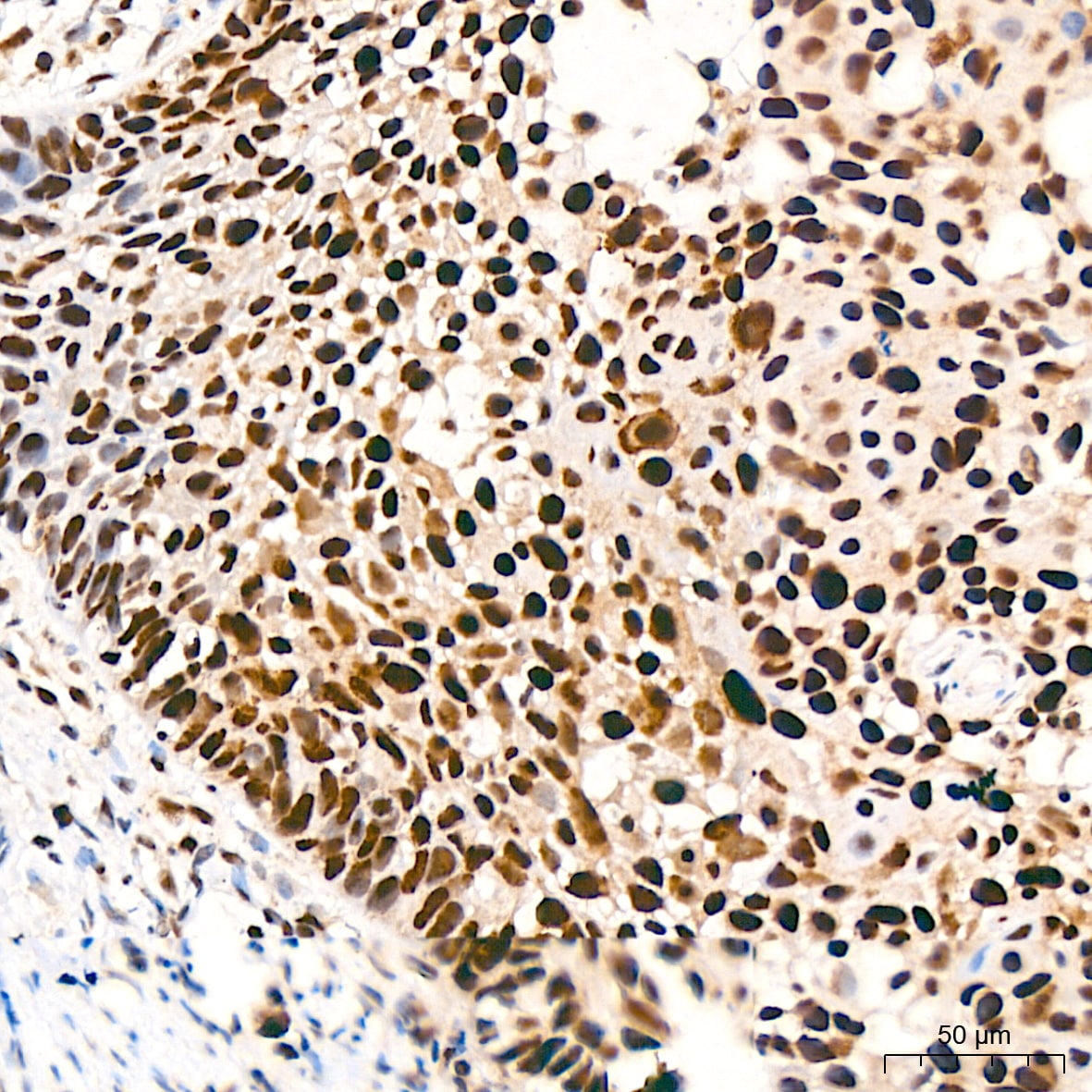 KAT1 Antibody (7U2O3)