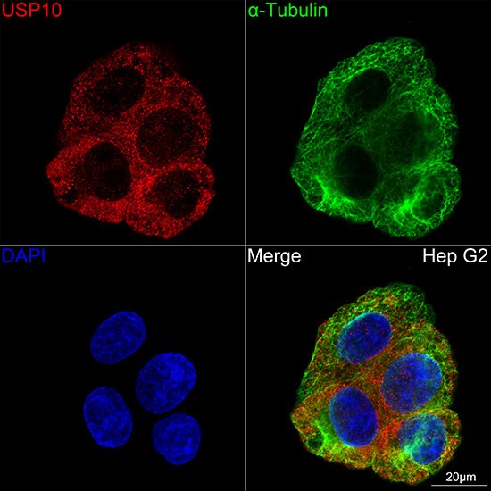 USP10 Antibody (9L6F3)