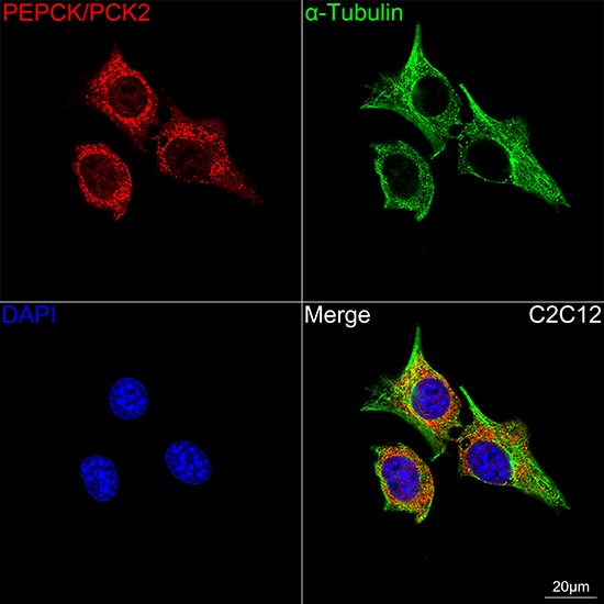 PCK2 Antibody (10L10J8)