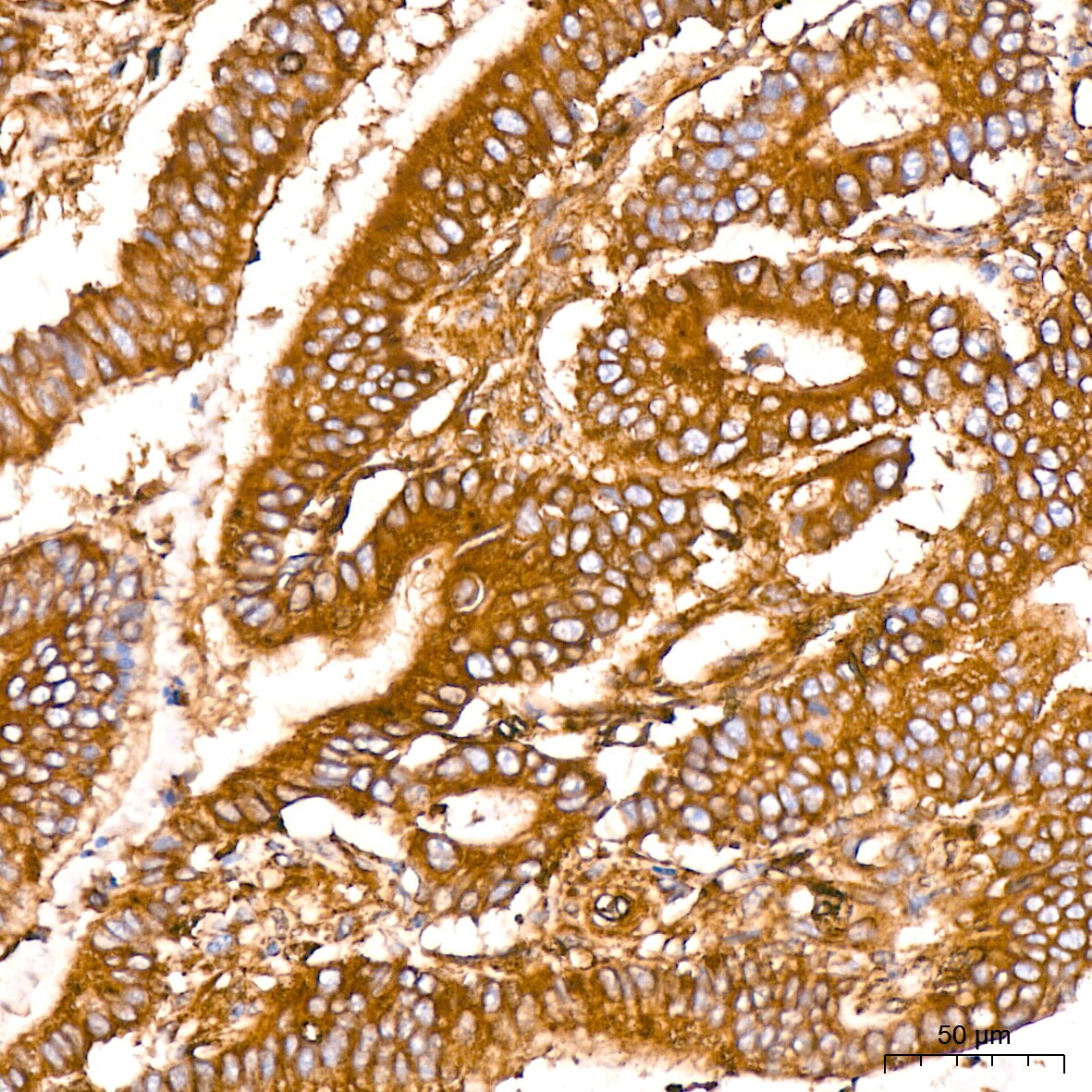 ACTR3 Antibody (8K4F2)