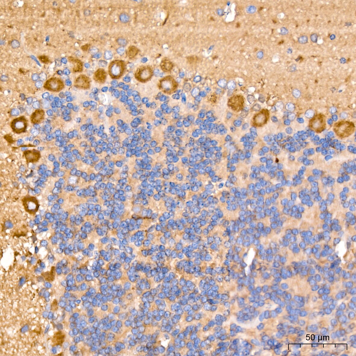 ACTR3 Antibody (8K4F2)