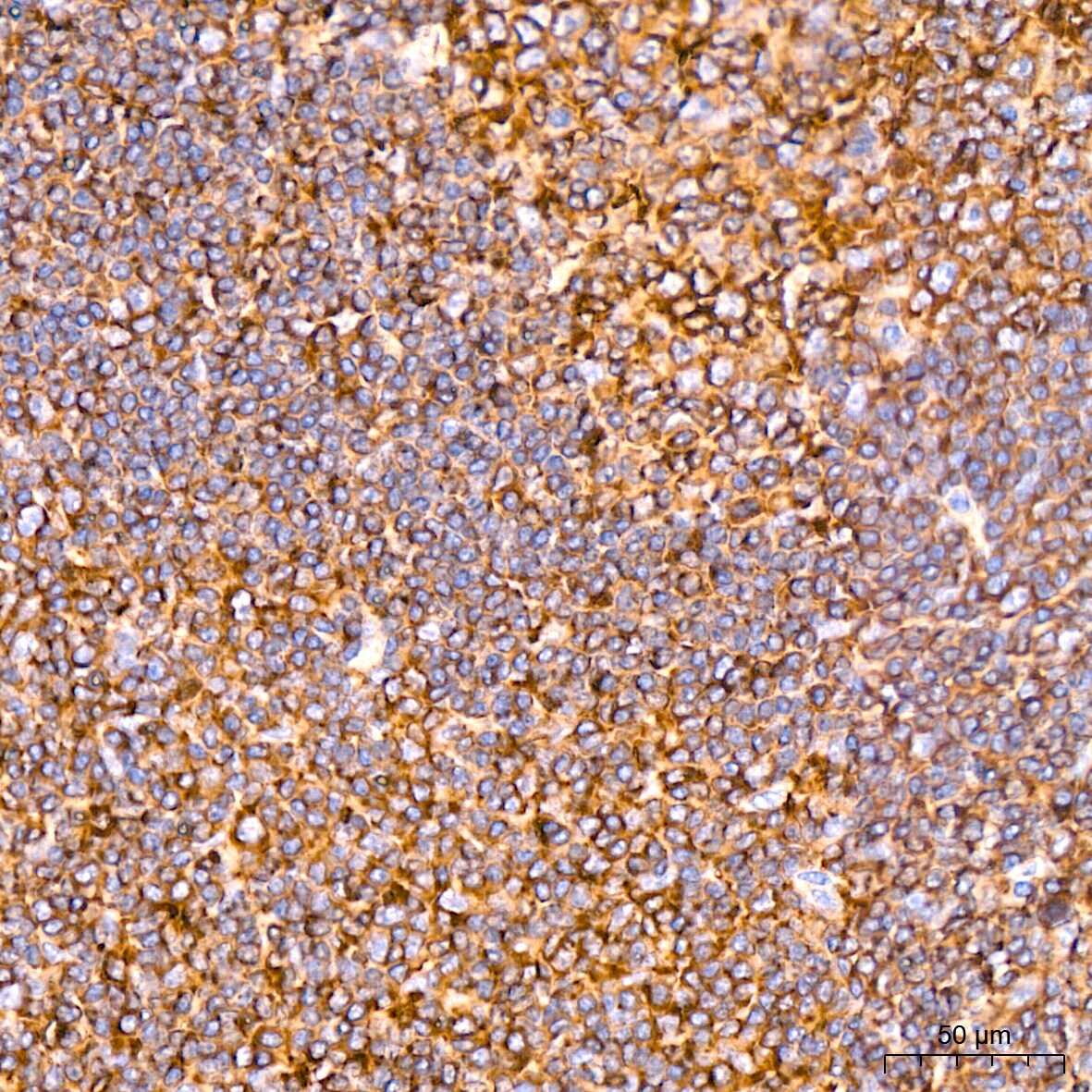 ACTR3 Antibody (8K4F2)