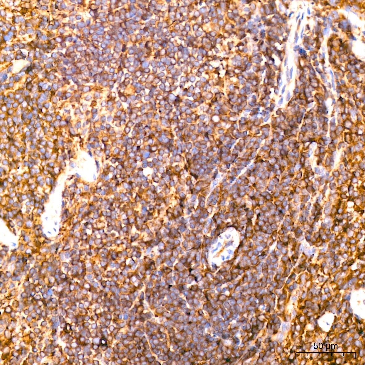 ACTR3 Antibody (8K4F2)