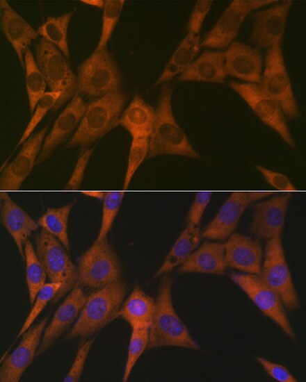 STAT4 Antibody (10H10O9)