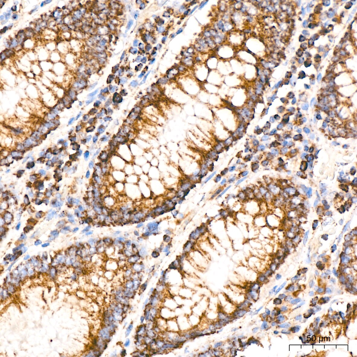 Aconitase 2 Antibody (0P3H3)
