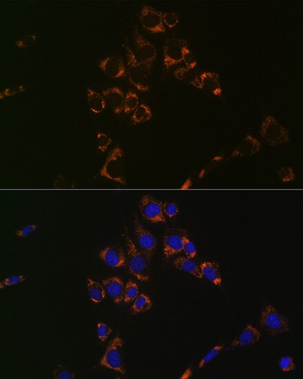 Aconitase 2 Antibody (0P3H3)