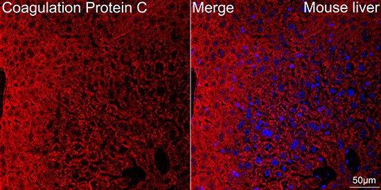 Coagulation Factor XIV/Protein C Antibody (3W3R7)