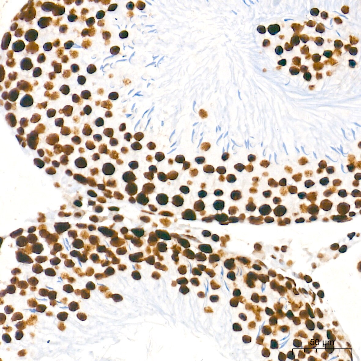 U2AF2 Antibody (8E8R9)