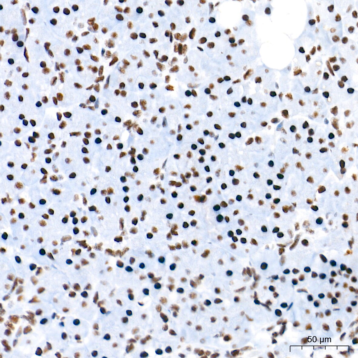 U2AF2 Antibody (8E8R9)