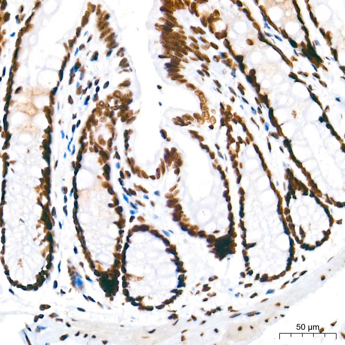 U2AF2 Antibody (8E8R9)