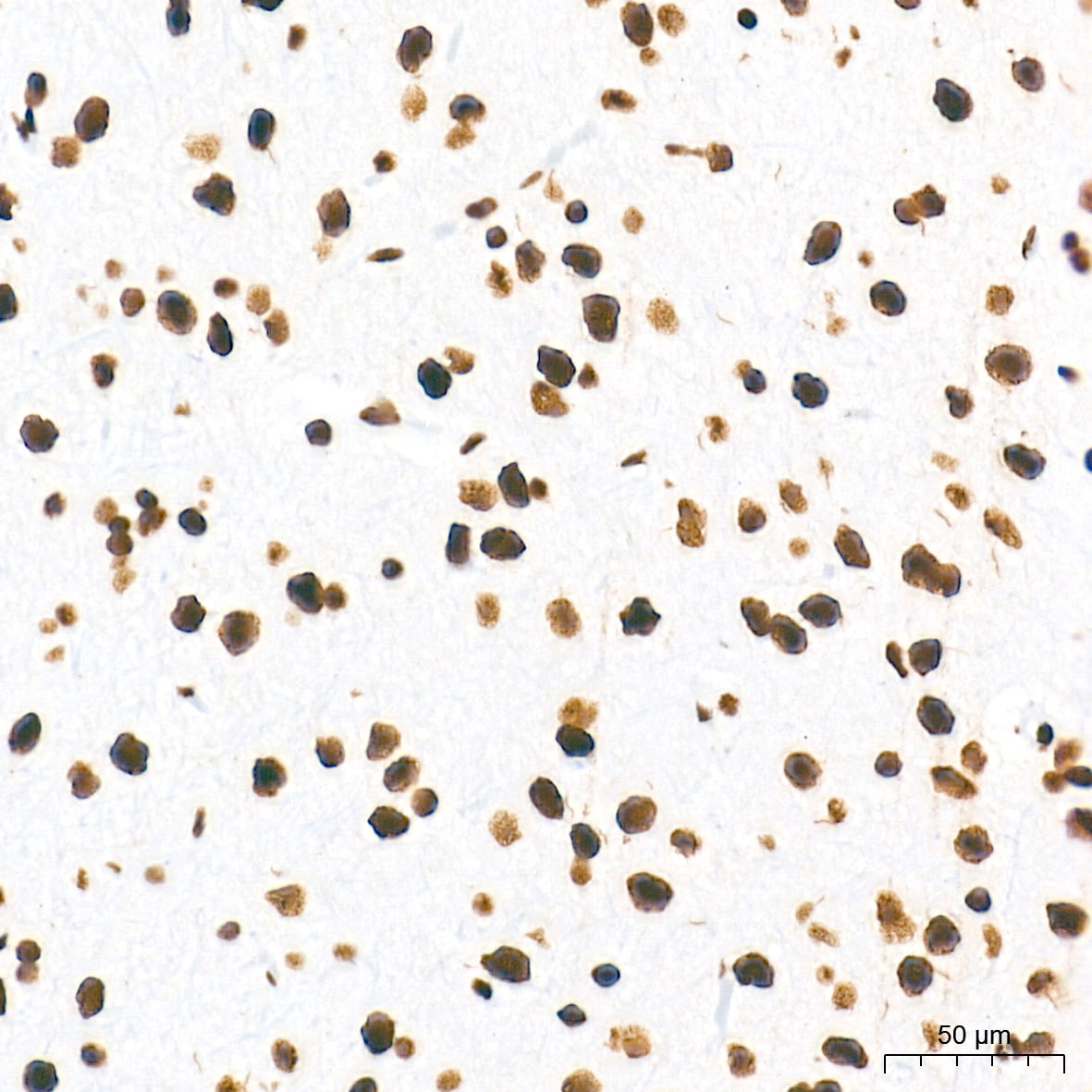 U2AF2 Antibody (8E8R9)