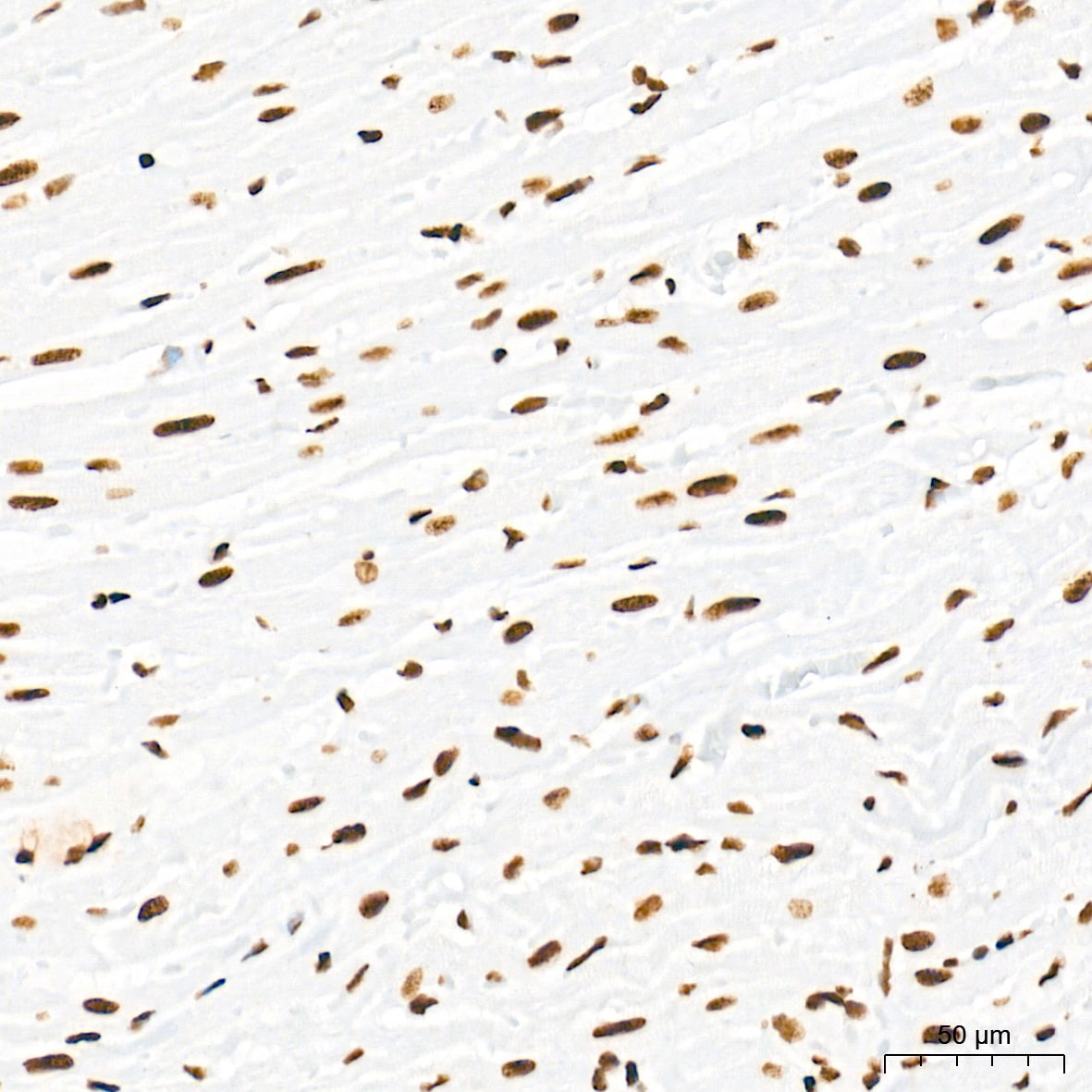 U2AF2 Antibody (8E8R9)