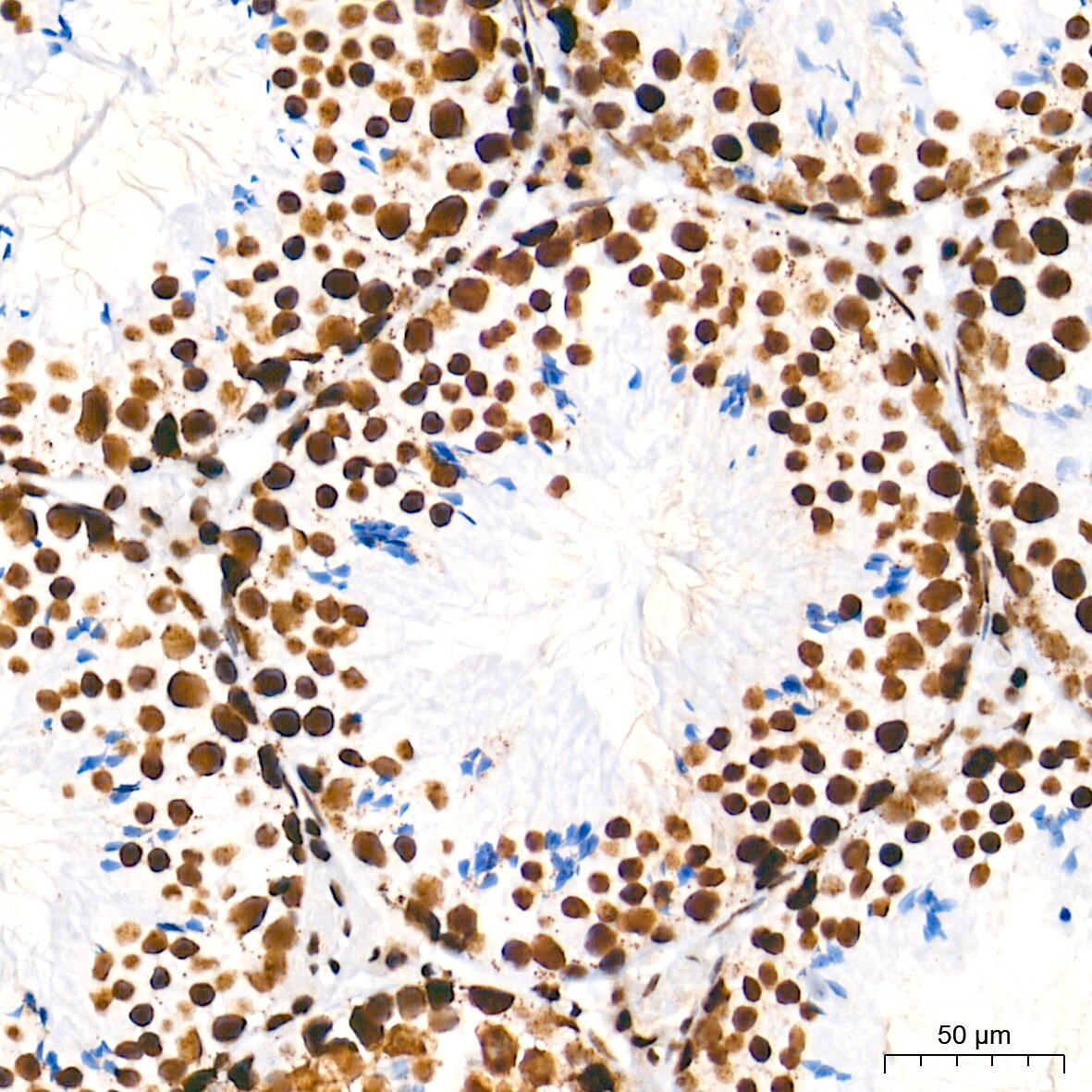 U2AF2 Antibody (8E8R9)