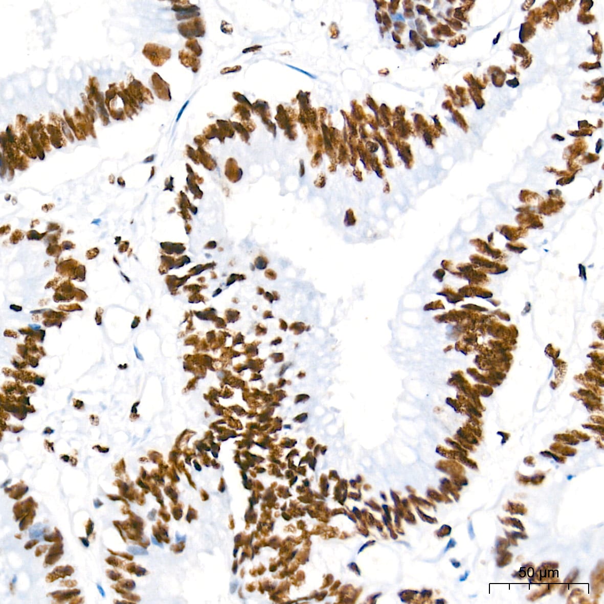 U2AF2 Antibody (8E8R9)