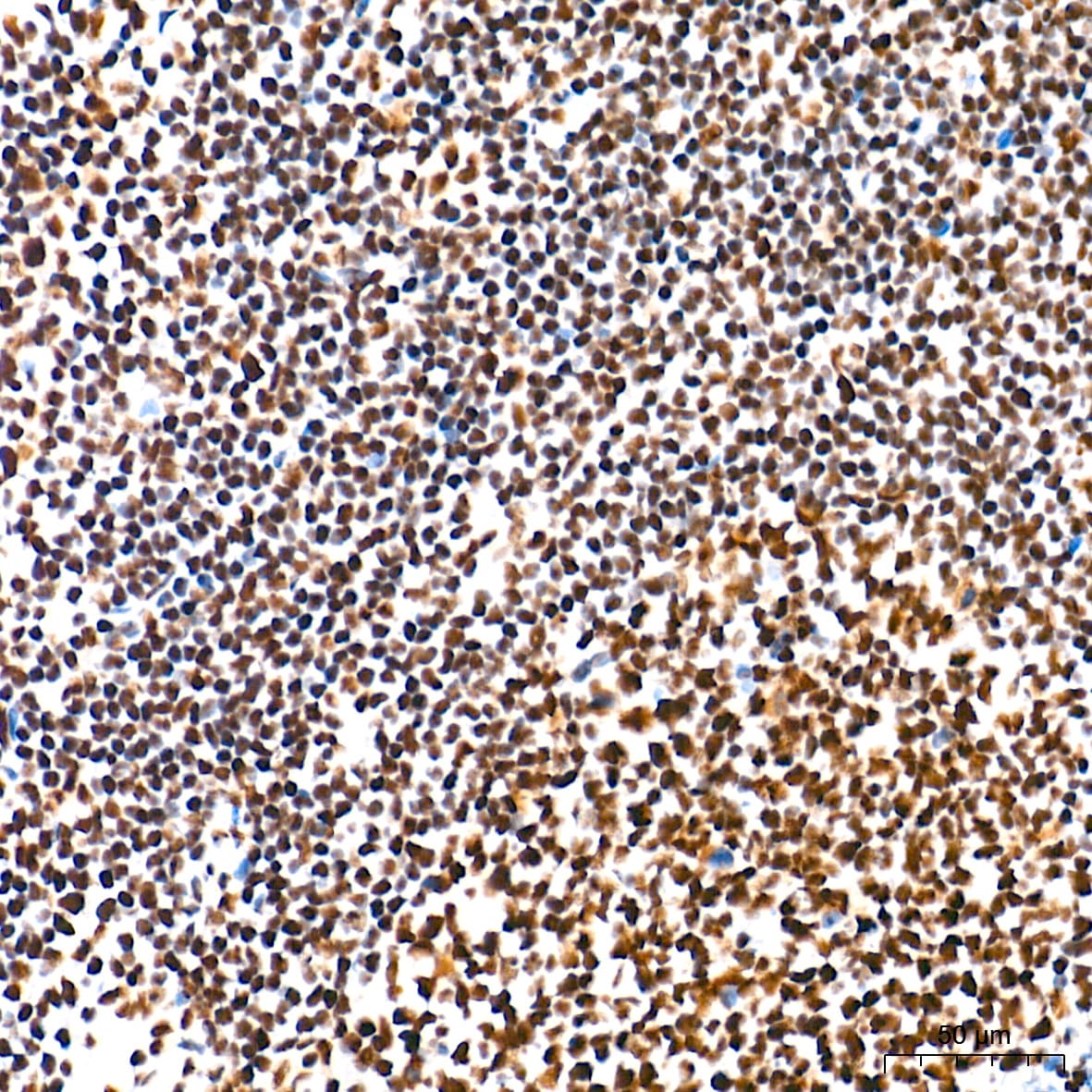 U2AF2 Antibody (8E8R9)