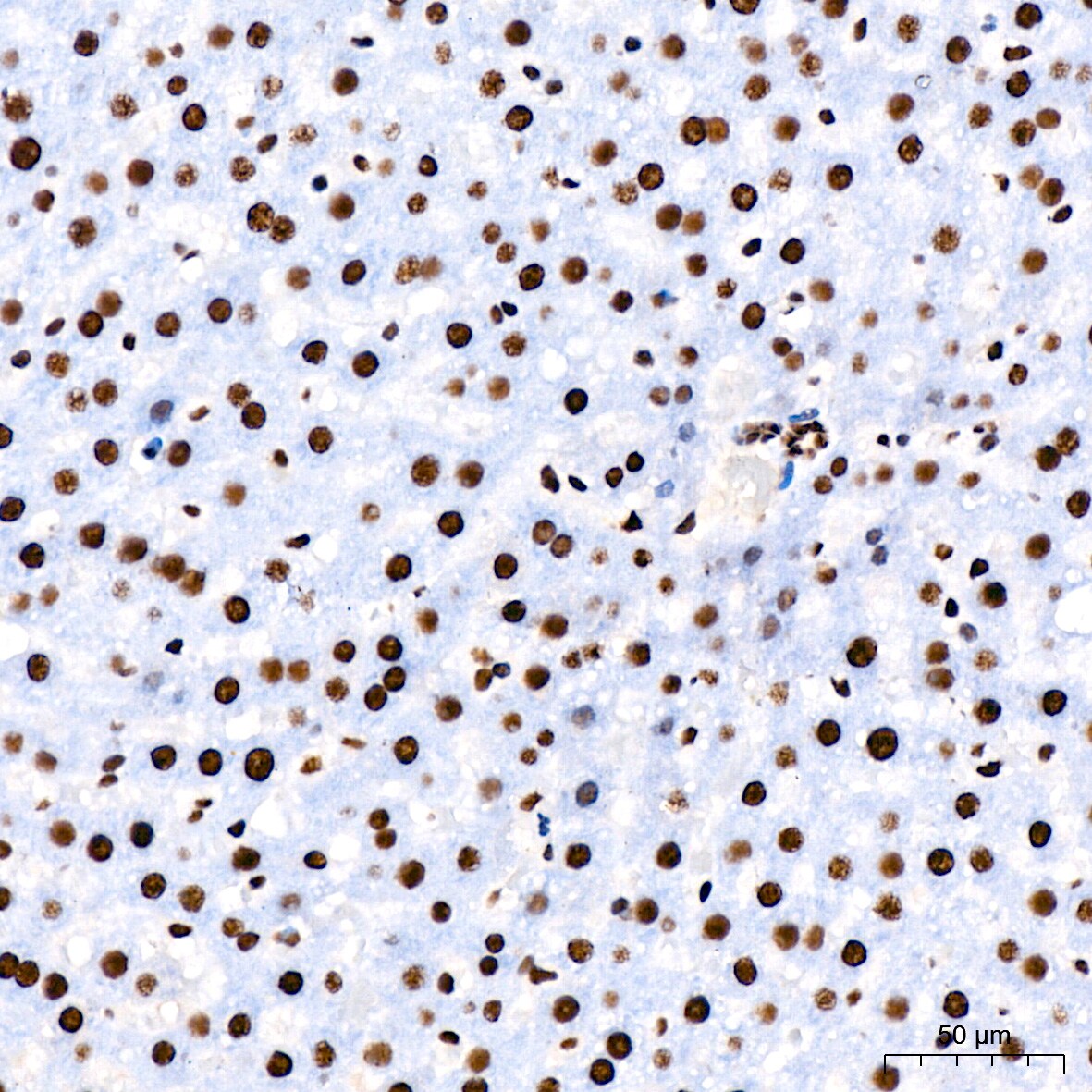 RNA Helicase A Antibody (2I6C5)