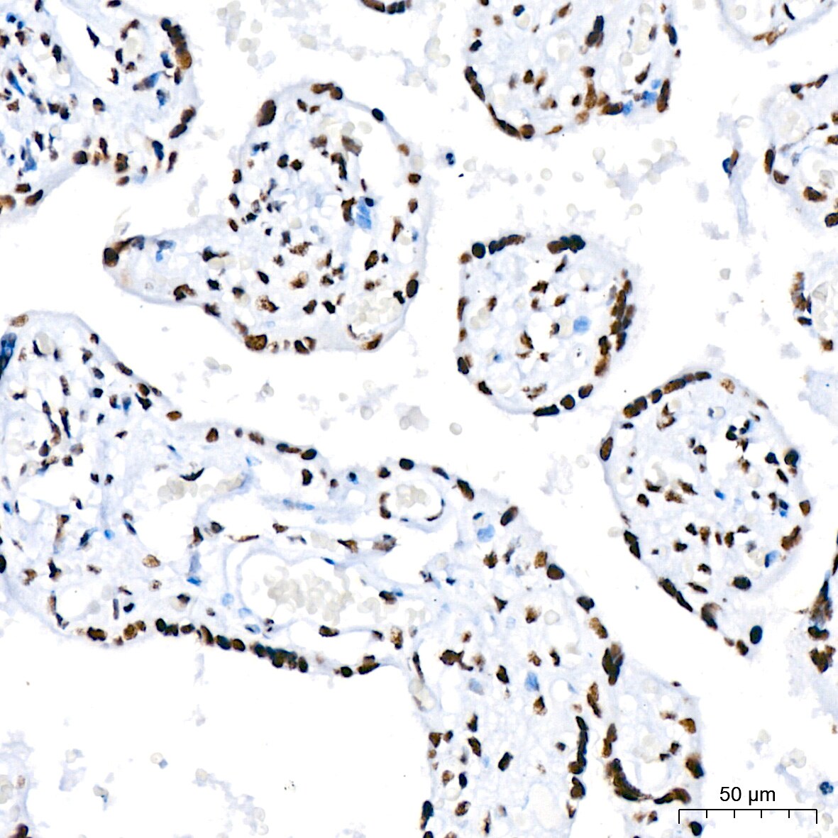 RNA Helicase A Antibody (2I6C5)