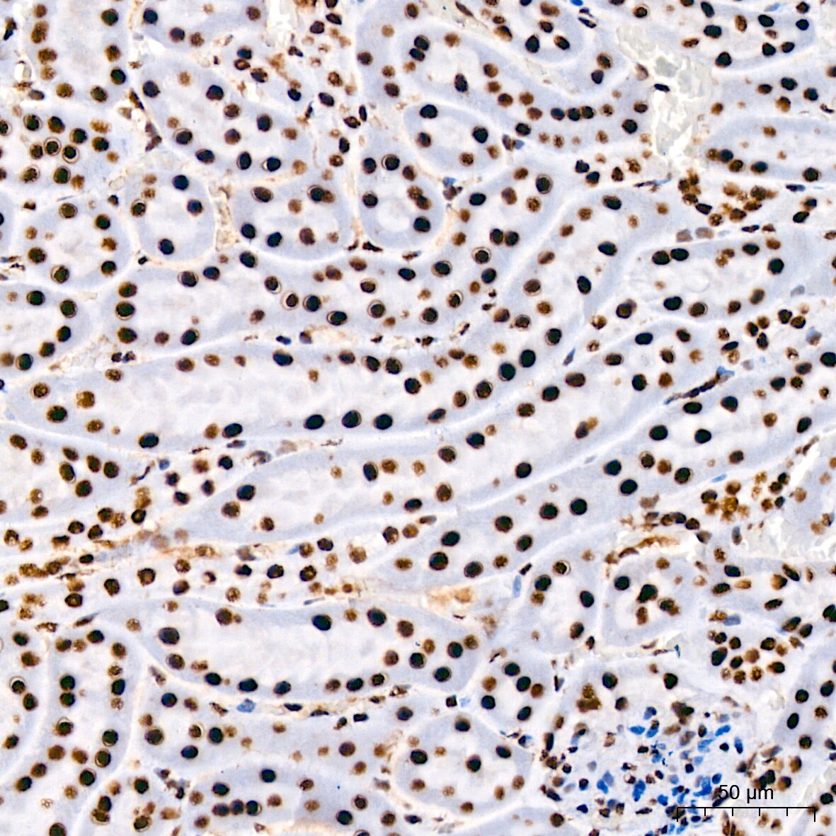 RNA Helicase A Antibody (2I6C5)