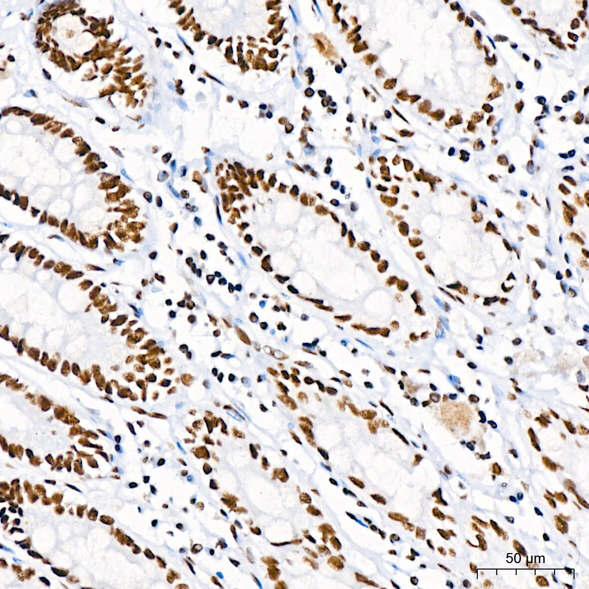 RNA Helicase A Antibody (2I6C5)