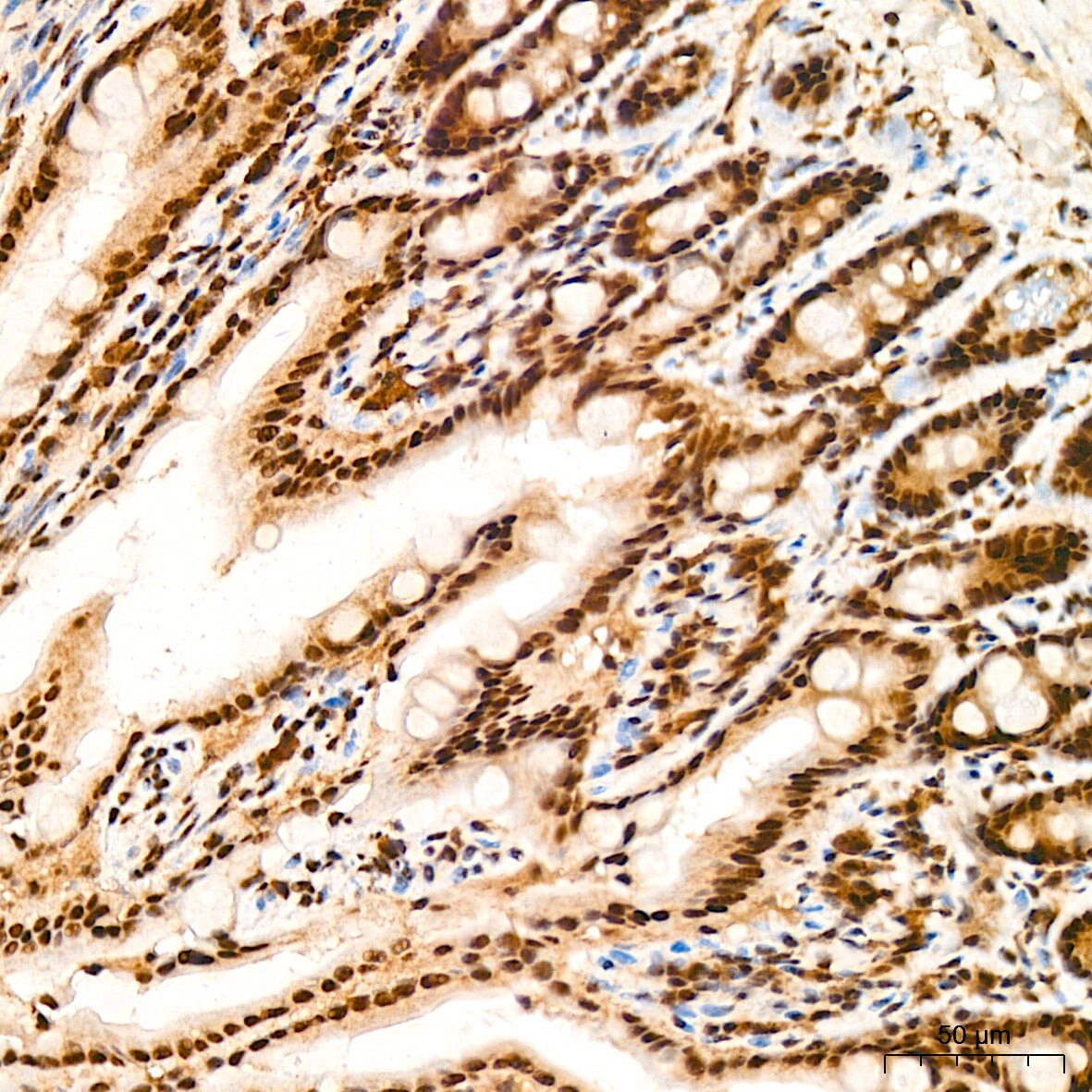PRPF8 Antibody (4I1Q8)