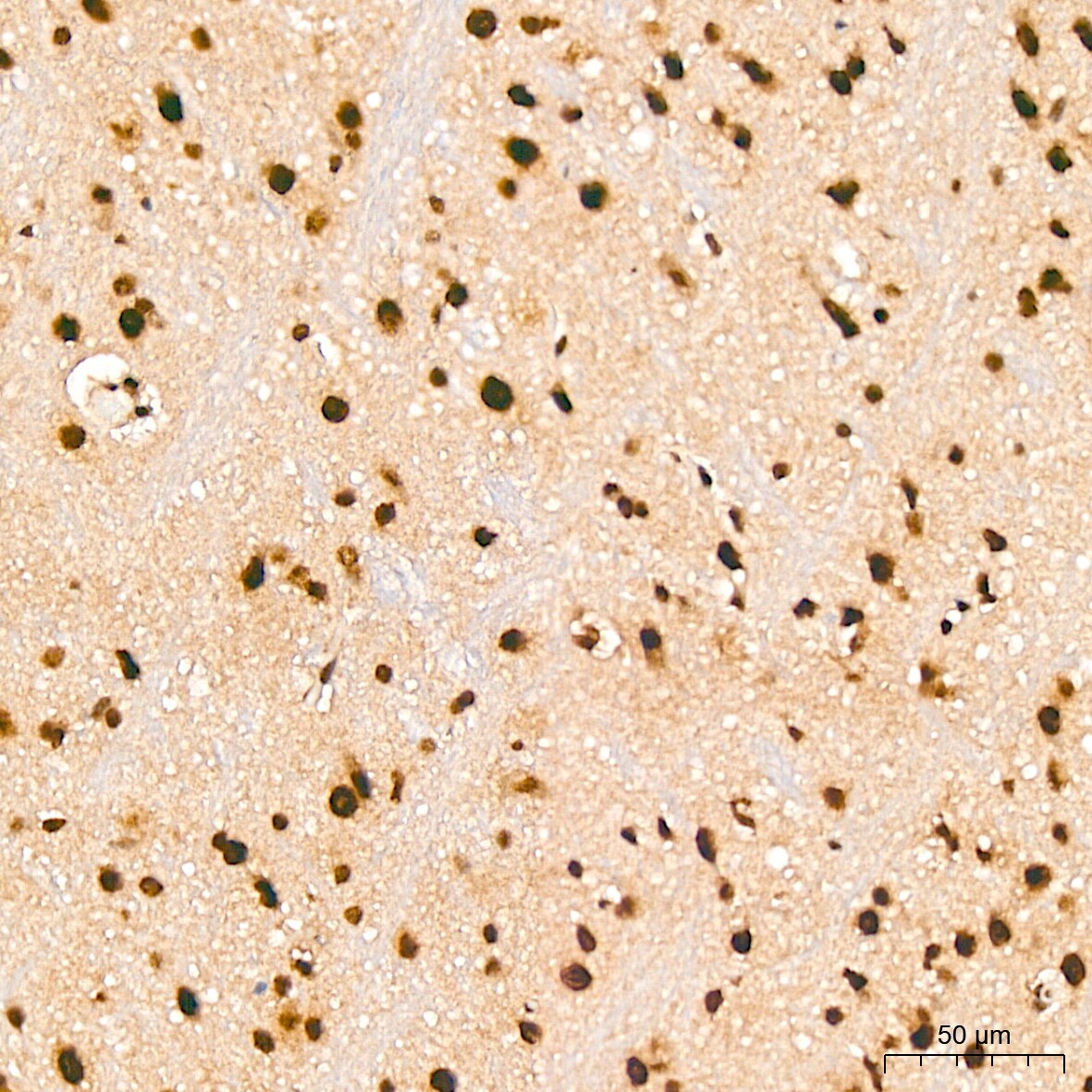 PRPF8 Antibody (4I1Q8)