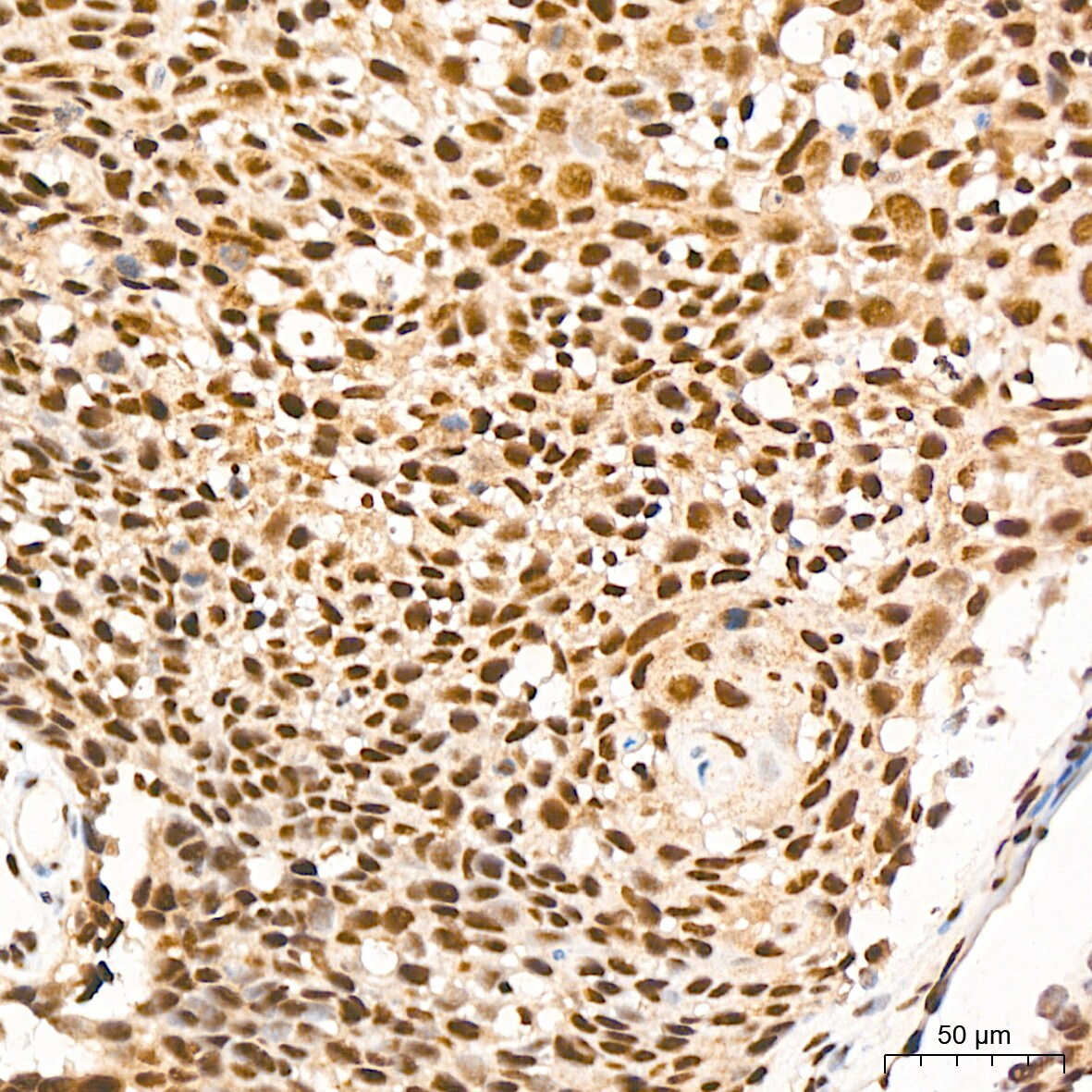 PRPF8 Antibody (4I1Q8)