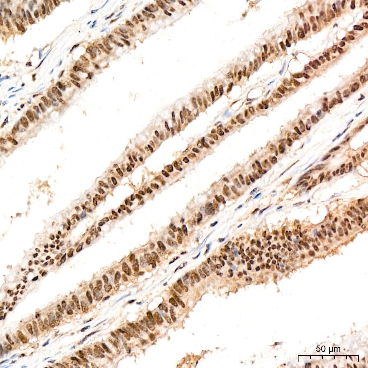 PRPF8 Antibody (4I1Q8)