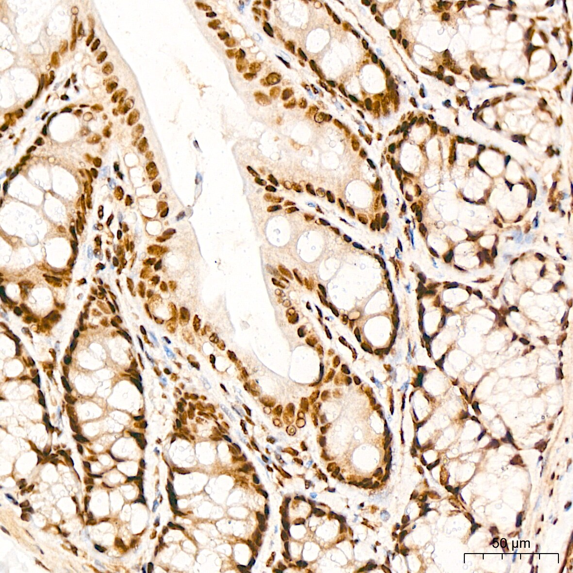PRPF8 Antibody (4I1Q8)