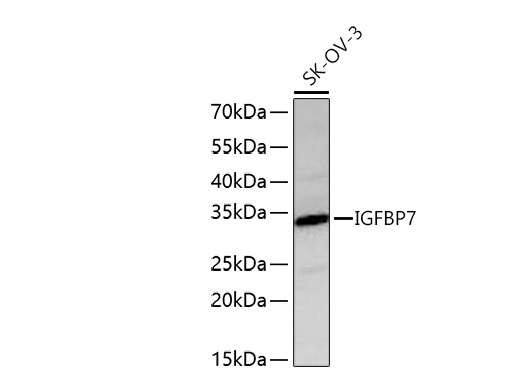 IGFBP-rp1/IGFBP-7 Antibody (8M10Q9)