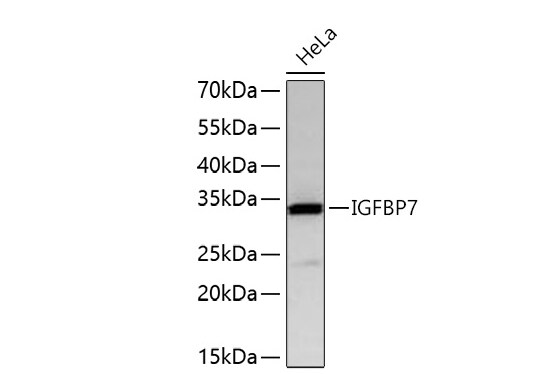 IGFBP-rp1/IGFBP-7 Antibody (8M10Q9)