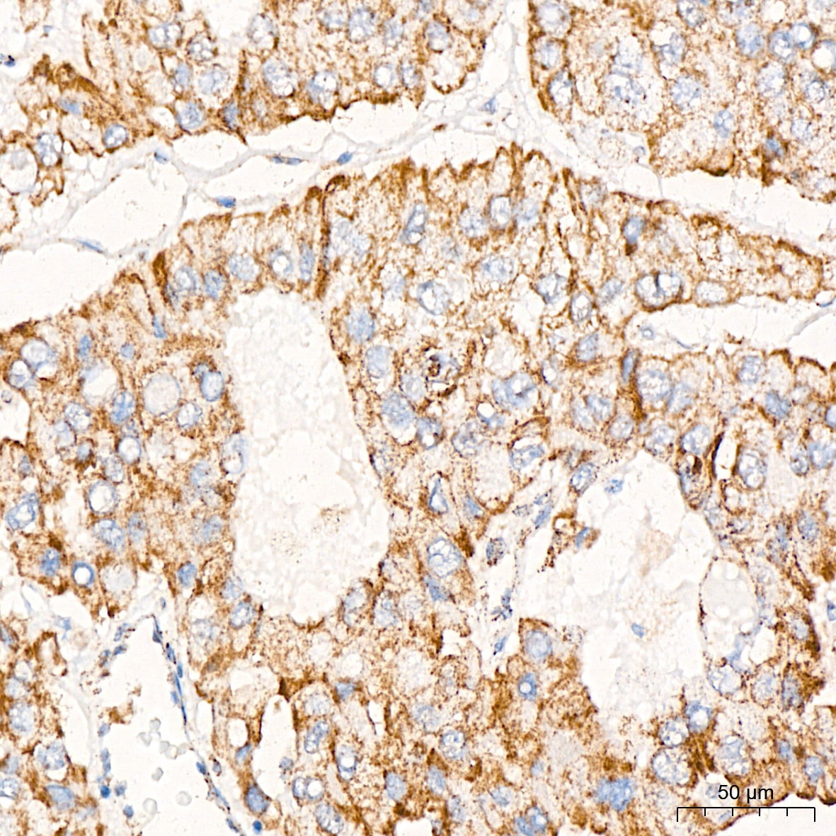 Pyruvate Dehydrogenase E1 beta subunit Antibody (7V8O5)