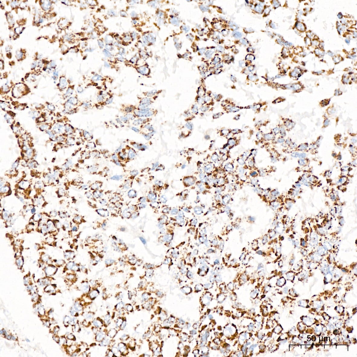 Pyruvate Dehydrogenase E1 beta subunit Antibody (7V8O5)