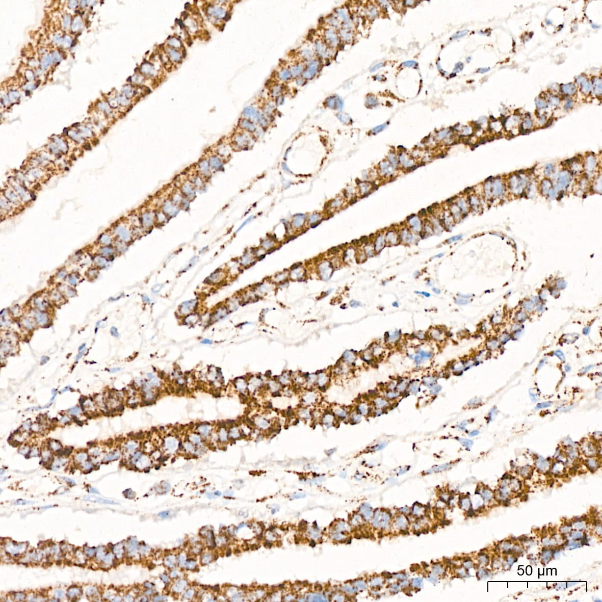 Pyruvate Dehydrogenase E1 beta subunit Antibody (7V8O5)