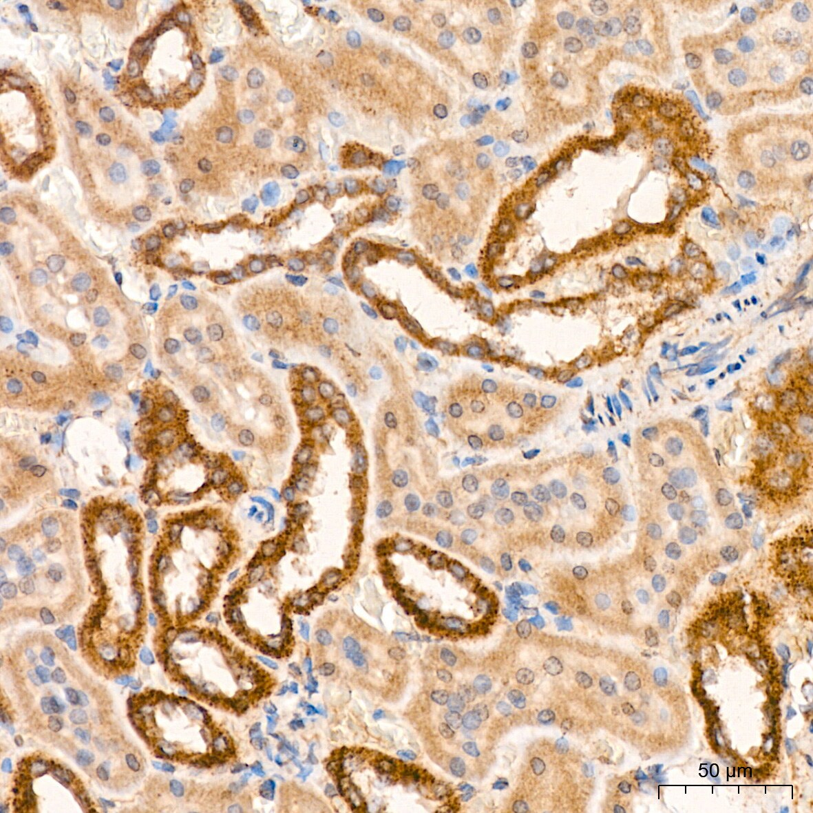 Pyruvate Dehydrogenase E1 beta subunit Antibody (7V8O5)