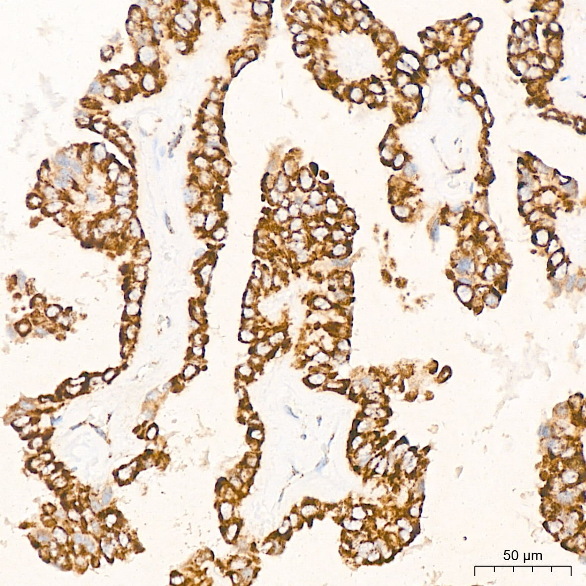 Pyruvate Dehydrogenase E1 beta subunit Antibody (7V8O5)